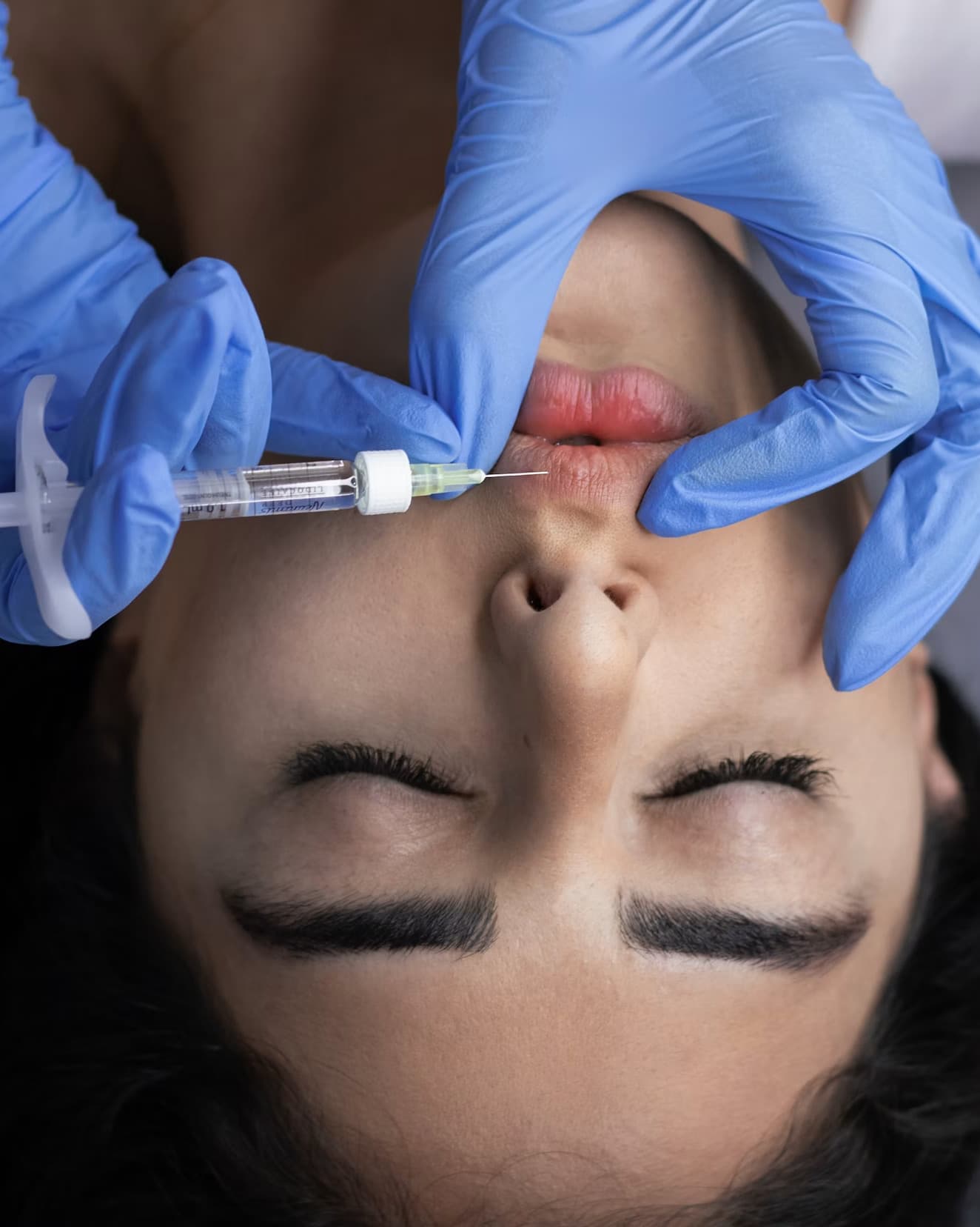 Dermal Fillers