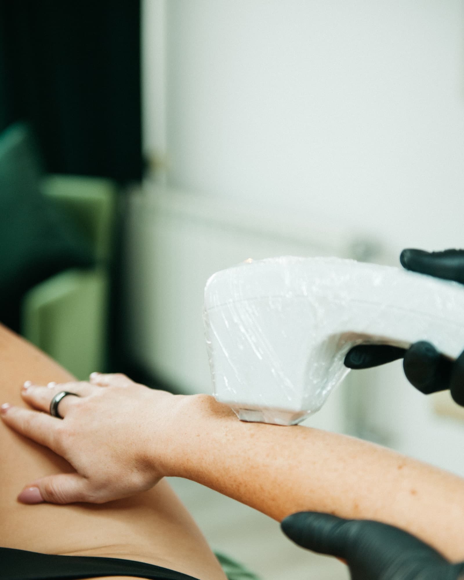 Vascular Treatment