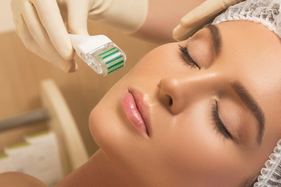 Microneedling treatment on the face